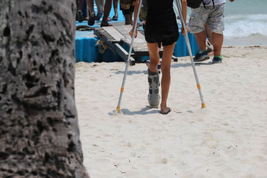 Female tourist on holiday with broken leg on a beach
